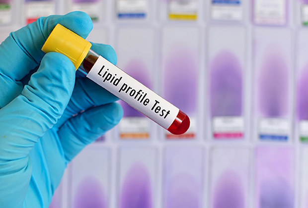 Thyroid Test in Dombivli