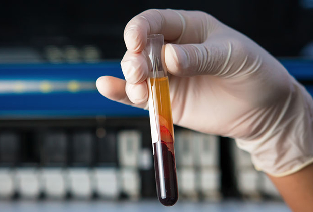 Thyroid Test in Dombivli